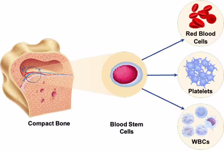 Essential Thrombocythemia (ET) process